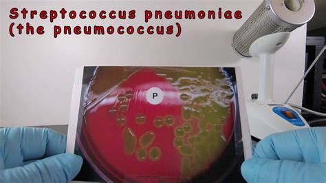 Alpha Hemolysis And Identification Of Streptococcus Pneumoniae Youtube