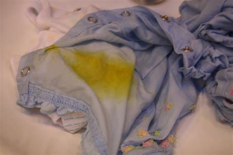 Mama Gone Green Baby Poop Stains And How To Get Rid Of Em