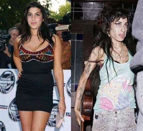 Amy Winehouse Sus Impactantes Fotos Antes Y Después De Su Adicción Al Alcohol Y Las Drogas