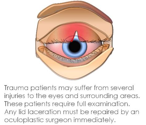 Eyelid Repair