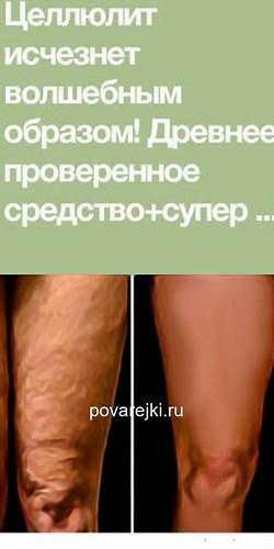 Диета по целлюлит Целлюлит исчезнет волшебным образом! | Целлюлит, Диета для плоского Целлюлит исчезнет волшебным образом! | Целлюлит, Диета для плоского Диета по целлюлит