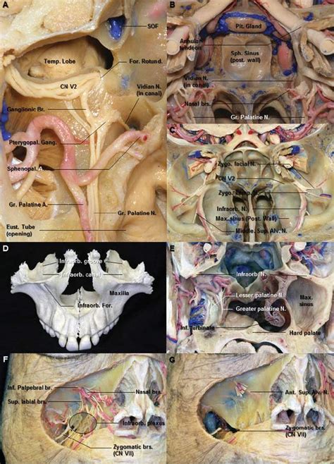The Pterygopalatine Fossa Orbit And Maxilla Neuroanatomy The