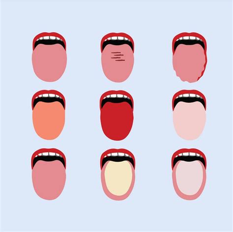 A Map Of The Inside Tongue Diagnosis In Traditional Chinese Medicine