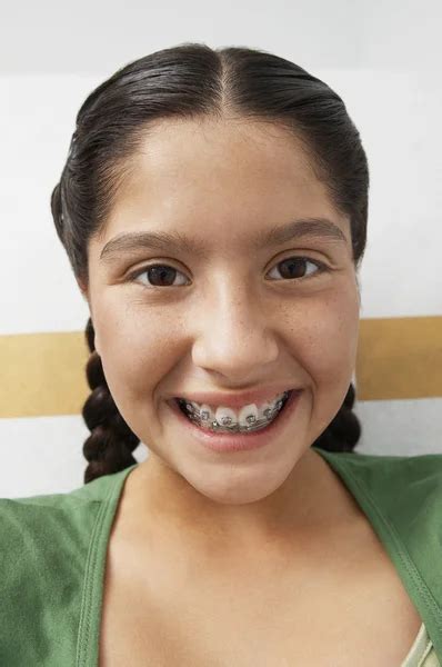 Closeup Of Teenage Girl With Braces Stock Photo By ©londondeposit 21975329