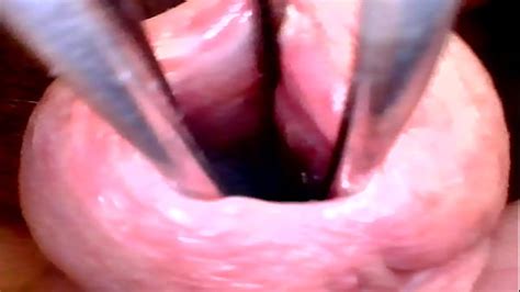 Deep Insight Into Wide Open Urethra Part 2and After Hot Waxing Xxx Mobile Porno Videos