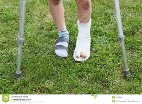 Legs Boy Crutches Left Leg Cast Stock Photos Free And Royalty Free