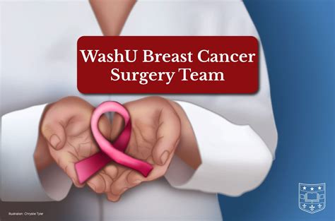 breast cancer care department of surgery washington university in st louis