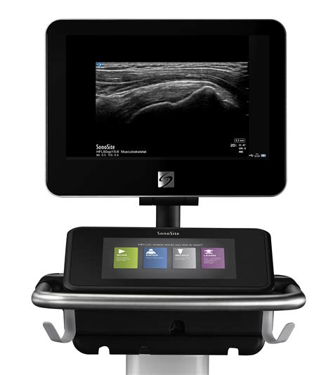Fujifilm Sonosite Exhibits Complete Point Of Care Ultrasound Portfolio