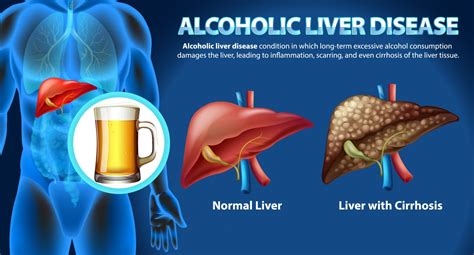 The Crucial Conversation Liver Health And Alcohol Consumption