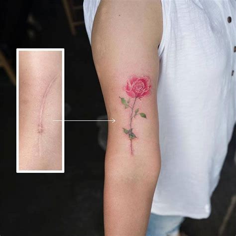 Inspirational Tattoos That Turn Scars Into Beautiful Works Of Art