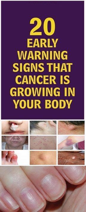 Early Warning Signs That Cancer Is Growing In Your Body