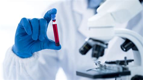 New Blood Tests Can Aid With Early Cancer Detection