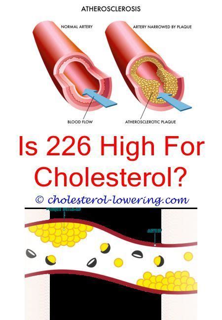 However, too much ldl can block blood find out which of your labs are not in the optimal range and how to get them there so that you can keep your immune system in top shape with lab. #cholesterollevelschart how to calculate your cholesterol ...