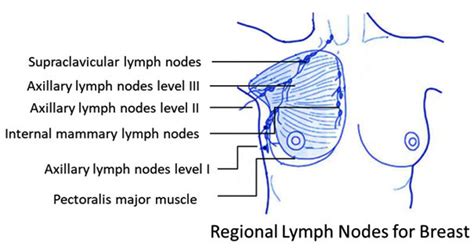 Regional Lymph Nodes For Breast Download Scientific Diagram
