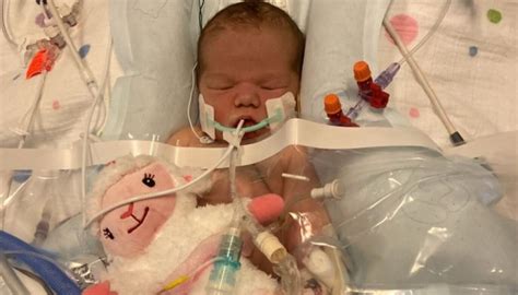 Gofundme Started For Baby Who Underwent Major Heart Surgery Bc News