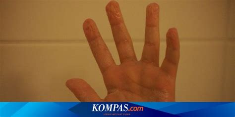 Misteri Tubuh Manusia Kenapa Air Bikin Jari Tangan Dan Kaki Keriput Halaman All Kompas