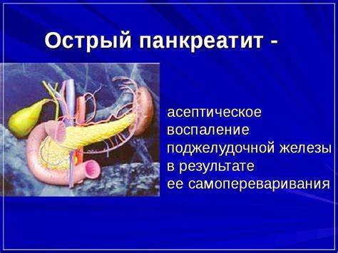 Панкреатит: 5 симптомов болезни, лечение, диета Картинка - Панкреатит: 5 симптомов болезни, лечение, диета