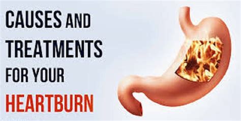 Heartburn Symptoms Causes And Treatment Apollo Hospital Blog