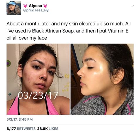 Pinterest Lowkeyywifeyy Face Skin Care Makeup Skin Care Skin Tips