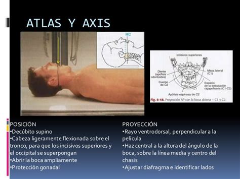 Manual Rx Columna Vertebral