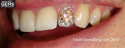 Full Tooth Is Full On Bling Tooth Gem Diamond Teeth Teeth Jewelry