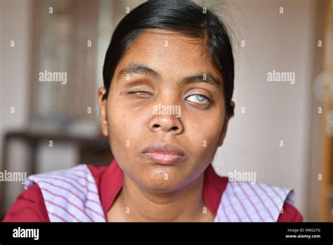 Blind Girls Hi Res Stock Photography And Images Alamy