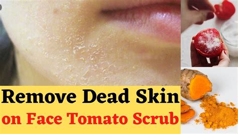 How To Remove Dead Skin From Face At Home How To Get Rid Of Dead Skin