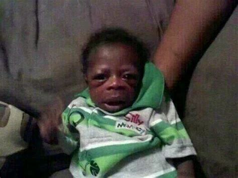 Ugly African Baby