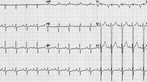 Check spelling or type a new query. Tanda Sakit Buah Pinggang Yang Perlu Anda Tahu
