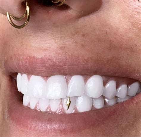 Tooth Gem Teeth Jewelry Tooth Gem Diamond Teeth