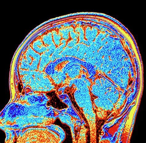 Coloured Ct Scan Of A Healthy Brain In Head Photograph By Alfred