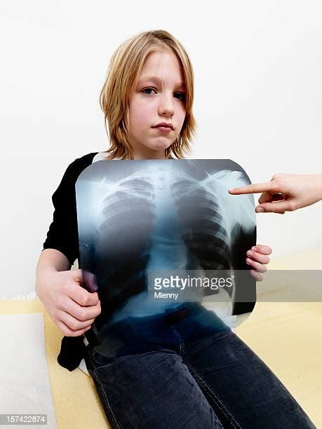 Normal Lung X Ray Stock Fotos Und Bilder Getty Images