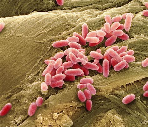 Pseudomonas Aeruginosa Bacteria Sem Photograph By Steve Gschmeissner