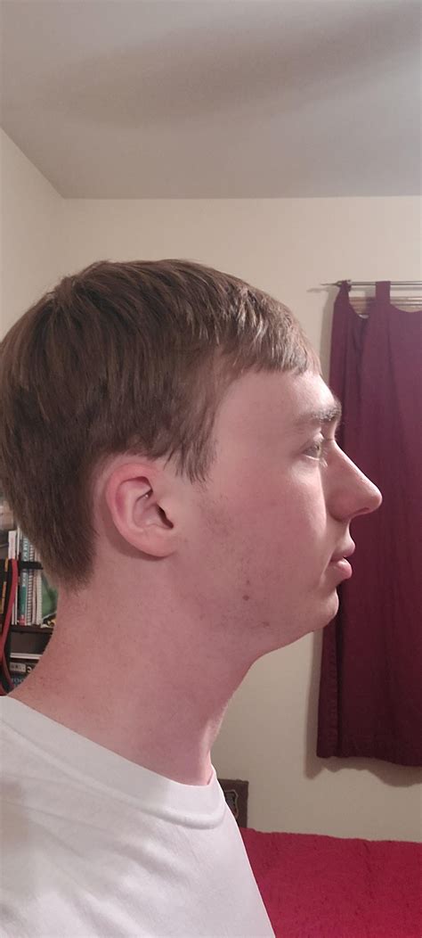 20m Glasses Or No Glasses Also Insecure About My Side Profile Be Honest Ramiugly