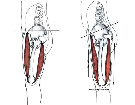 Hamstring Injury In Football The Physio Lounge