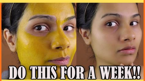 How To Get Rid Of Hyperpigmentation On Face Naturally Remove Dark