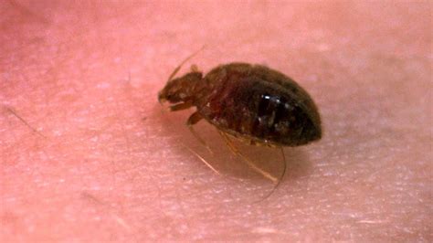A Bedbugs Bite Up Close Bang Goes The Theory Bbc