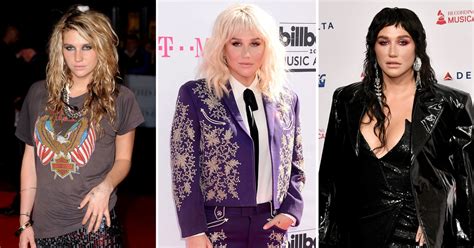 Kesha Transformation See How The Tik Tok Singer Has Changed