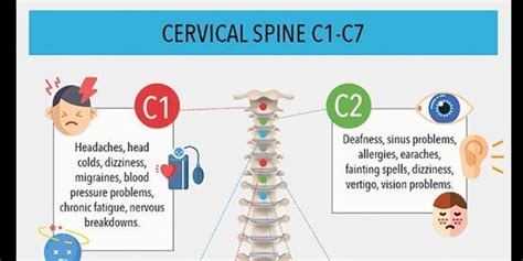 Symptoms Of Spinal Misalignment C1 Through C7