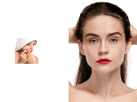 mascarilla negra poros toallitas para el acné propiedades