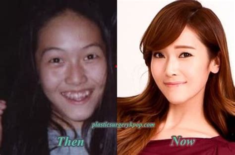 Tiffany Girls Generation Before Plastic Surgery