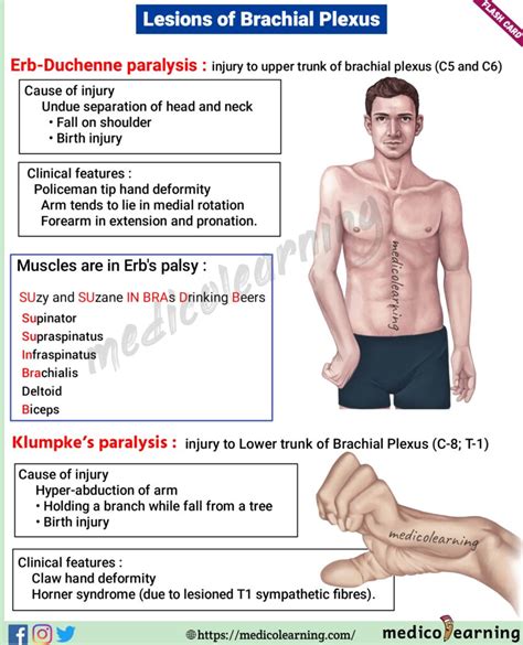 Brachial Plexus Lesions Medicolearning