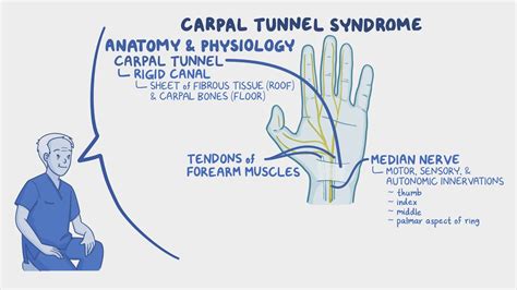 Carpal Tunnel Syndrome Nursing Osmosis Video Library