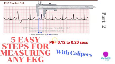 How To Measure And Interpret Ekgs In 5 Easy Steps With Calipers Youtube