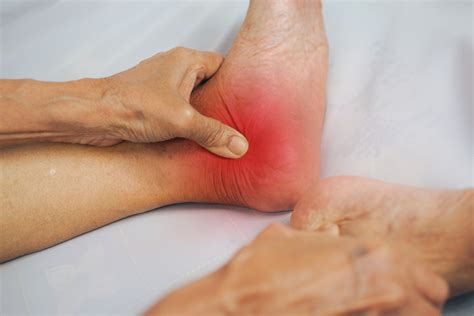 A New Treatment For Ankle Arthritis Myhealth Bytes