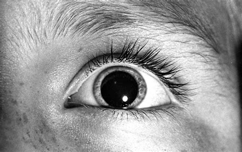 Eye Opener Why Do Pupils Dilate In Response To Emotional States