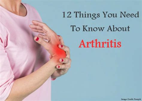 12 Things You Need To Know About Arthritis Rheumatoid Arthritis Facts