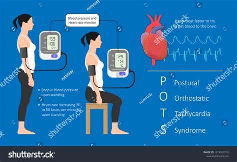 16 Postural Orthostatic Tachycardia Images Stock Photos And Vectors