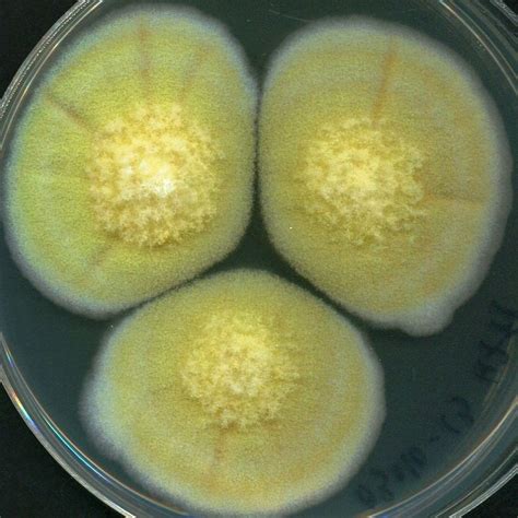 Docencia Microbiología Umhcultivo De Hongos Filamentosos Y Levaduras