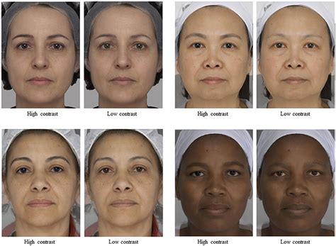 Human Skin Color Genetics